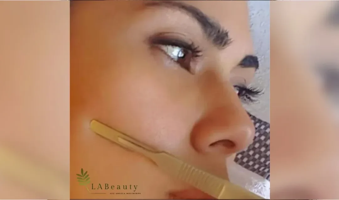 ¡Todo lo que necesitas saber sobre el Dermaplaning!